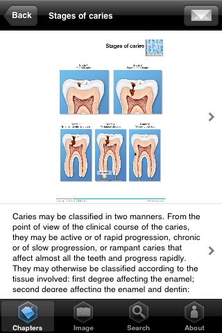 Miniatlas Dentistry screenshot-3