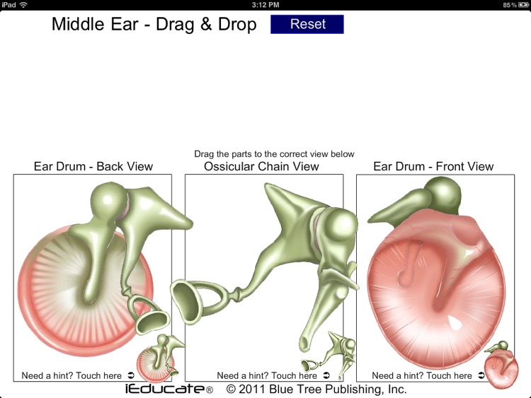 Middle Ear DnD