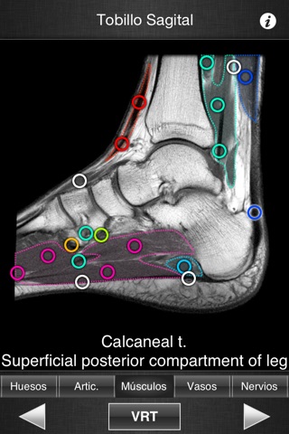 Monster Anatomy HD - Lower Limb screenshot 3