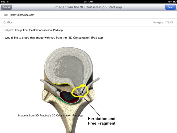 3D Consultation screenshot-4