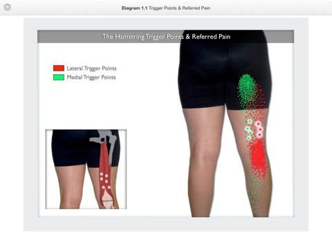 Trigger Point Therapy for the Hamstrings by Laura Perry & Jeff ...