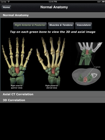CTisus: CT of the Hand & Wrist screenshot 2