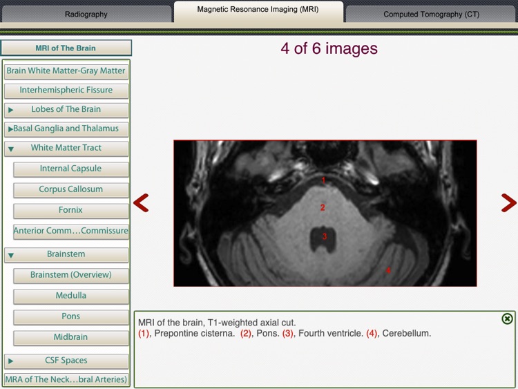 MRI-Xray Human Body screenshot-4