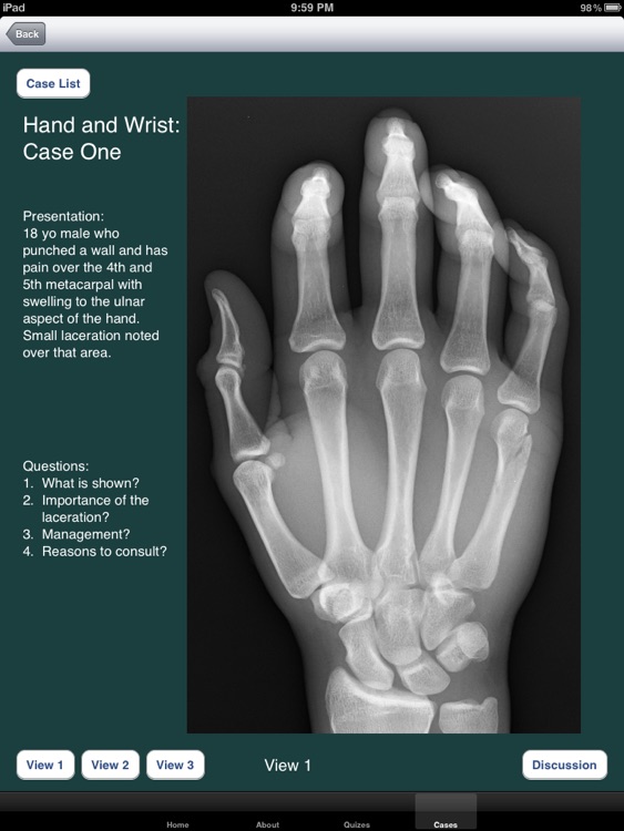 FracturED: A Fracture in the ED; Module 1: Hand and Wrist