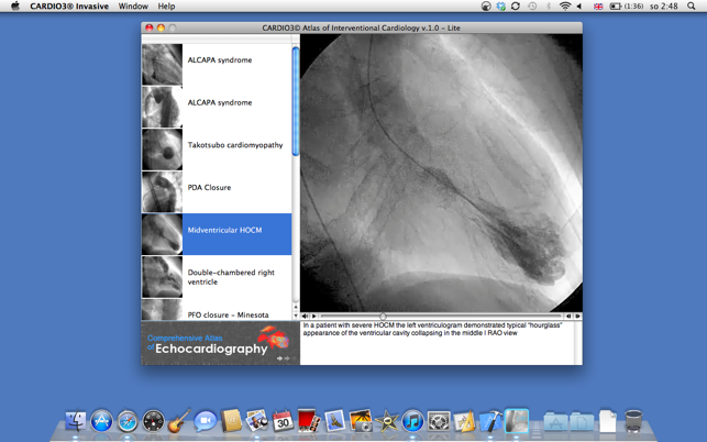 CARDIO3® Atlas of Interventional Cardiology – Lite(圖2)-速報App