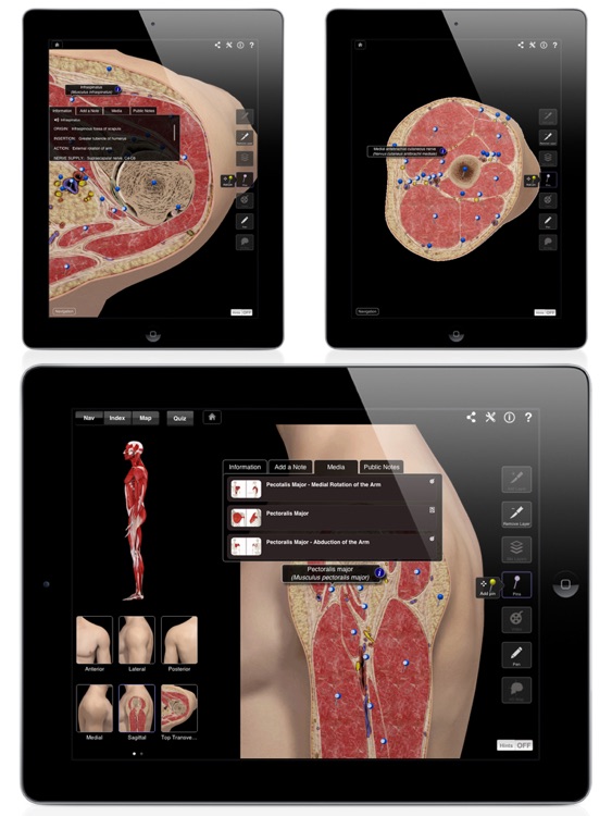Shoulder Pro III for iPad
