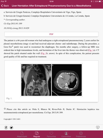 Cirugía Española (English Edition) screenshot 4