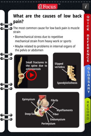 Animated Quick Reference Guide - Backpain(圖2)-速報App