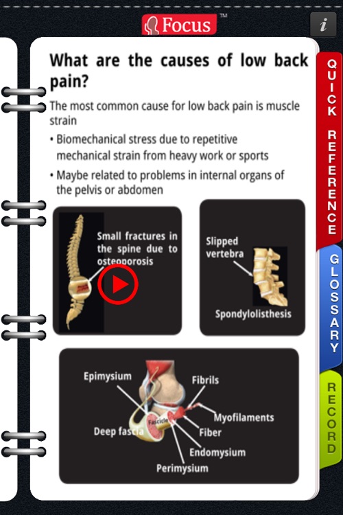 Animated Quick Reference Guide - Backpain