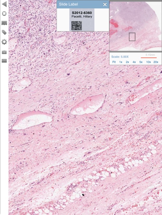 Aperio ePathViewer for iPad