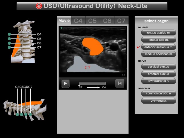 USU neck-lite(圖3)-速報App