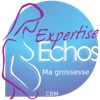 Expertise Echos CBM