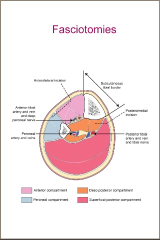 Leg.Fractures screenshot 3