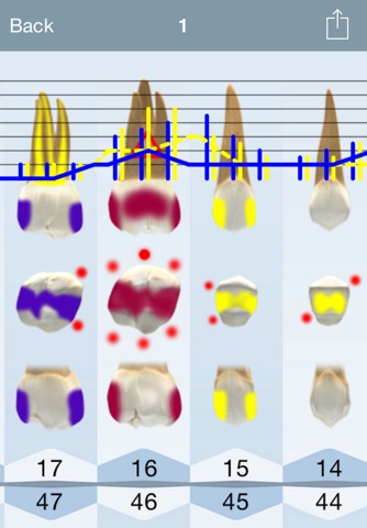 DentalChart Pocket screenshot 2