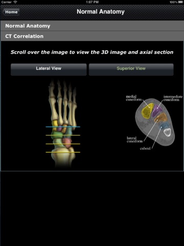 CTisus: CT of the Foot screenshot 3