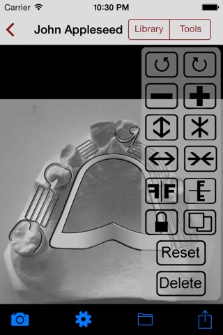 DentALL Removable Partial Denture Designer screenshot 2