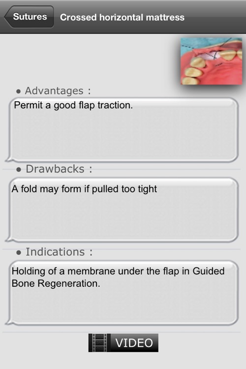 Suturing techniques Videos