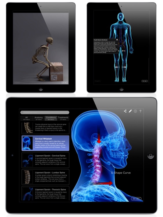Orthopedic Patient Education