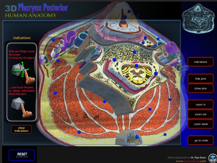 3D Pharynx Posterior