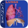 Lungs Cancer II