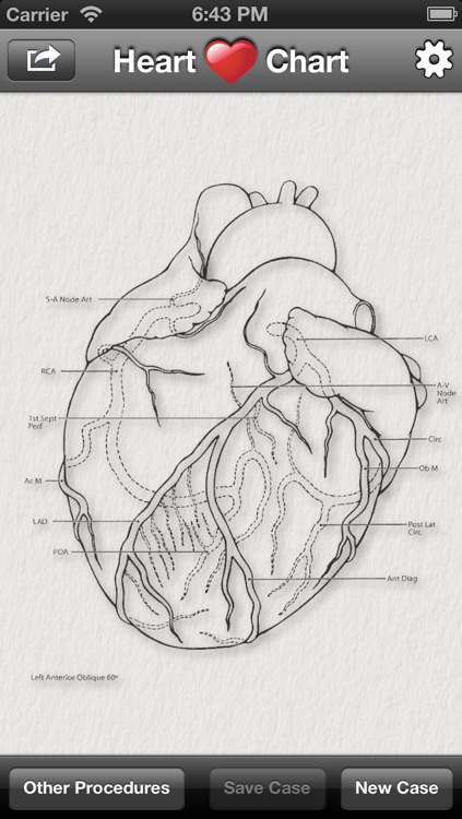 Heart Chart