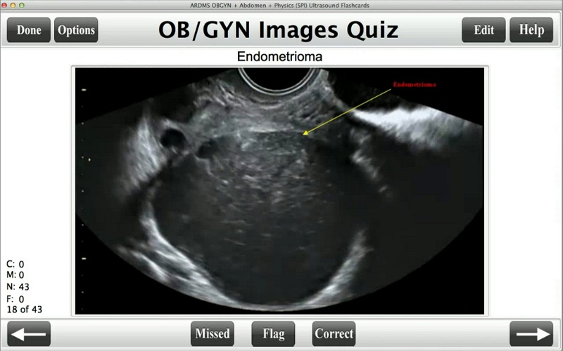 ARDMS Ultrasound Flashcards Board Review Lite thumbnail 2