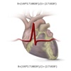 CardioScores