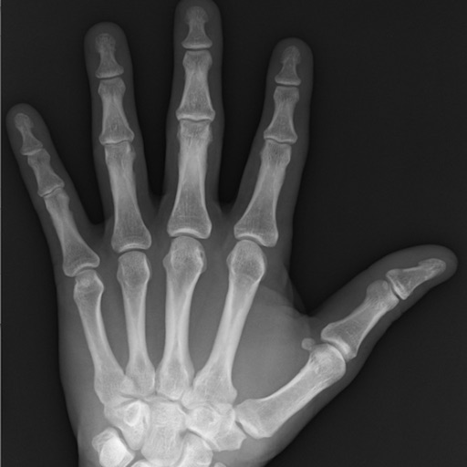 FracturED: A Fracture in the ED; Module 1: Hand and Wrist