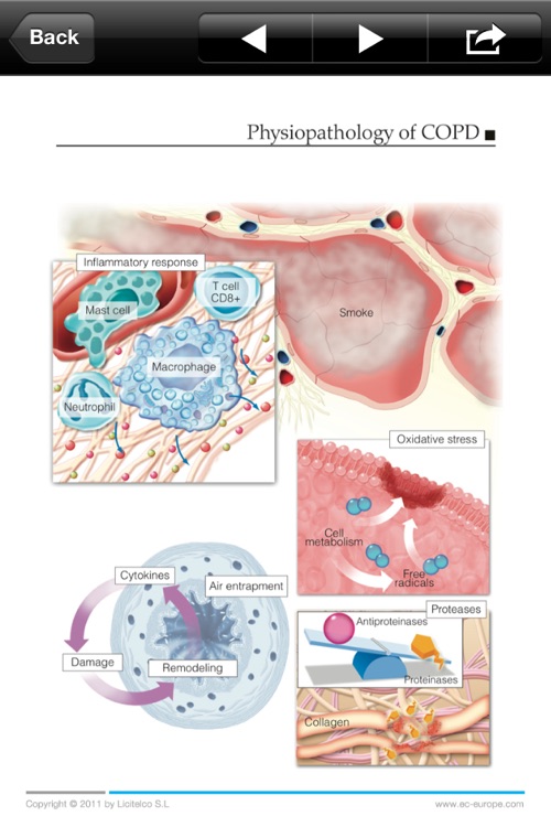 Miniatlas COPD