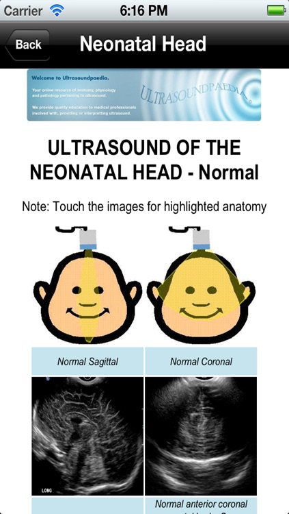Ultrasoundpaedia