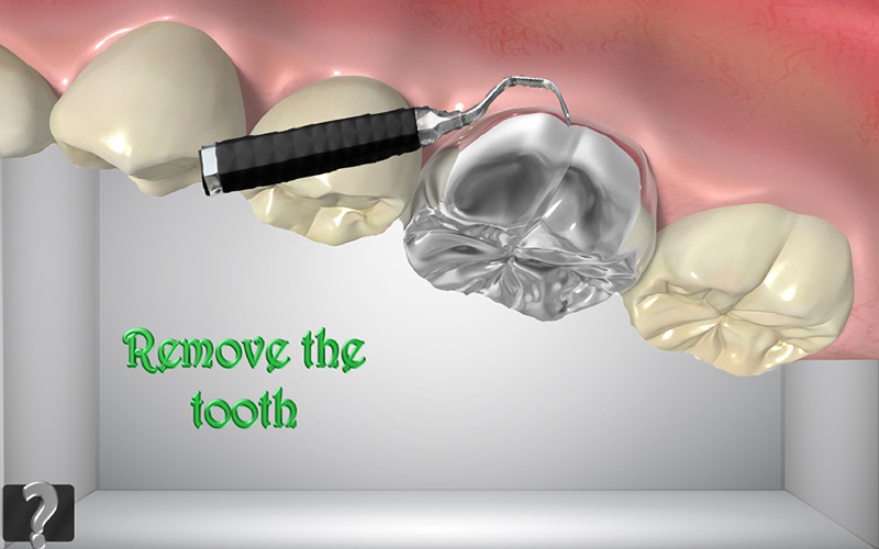 Dentist Surgery Game thumbnail 3