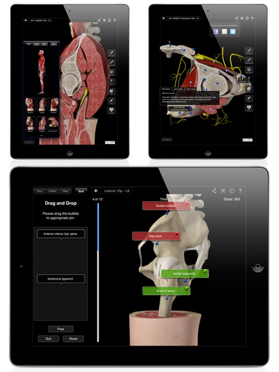 Hip Pro III for iPad screenshot-4