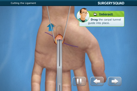 Virtual Carpal Tunnel Surgery screenshot 2
