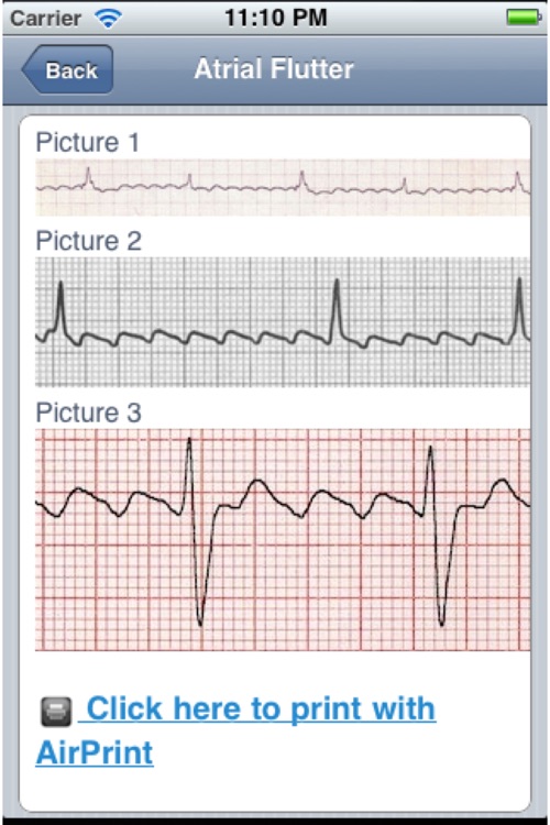 ECG screenshot-4