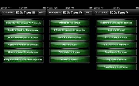 ECG Electrocardiograma Tipos screenshot 2