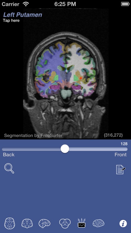 iSurf BrainView screenshot-4