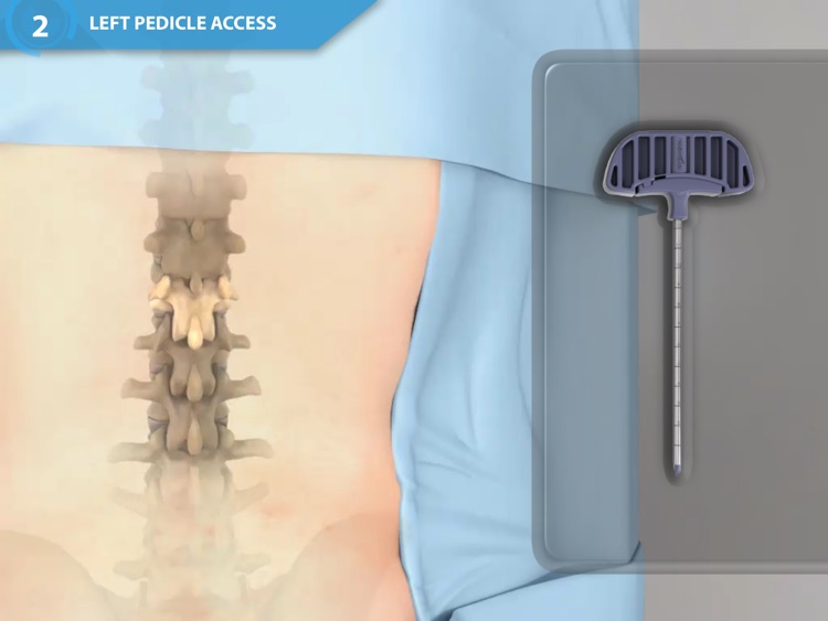 BKP Procedure Sim screenshot-4