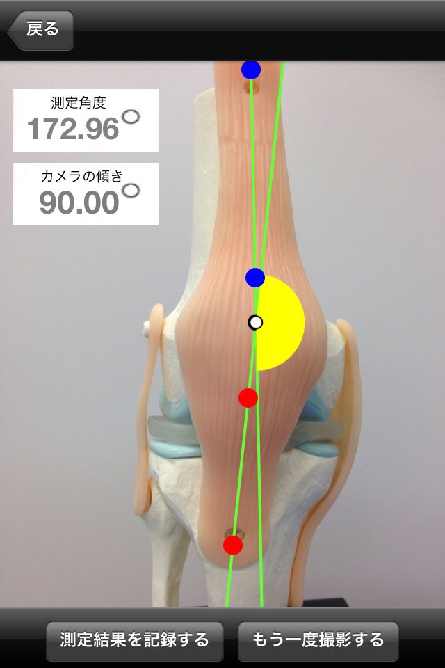 4点 角度 可動域測定 screenshot 3