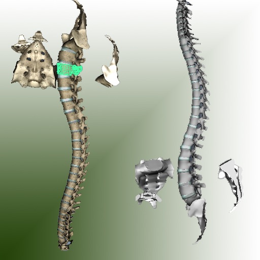 3D Vertebral Column