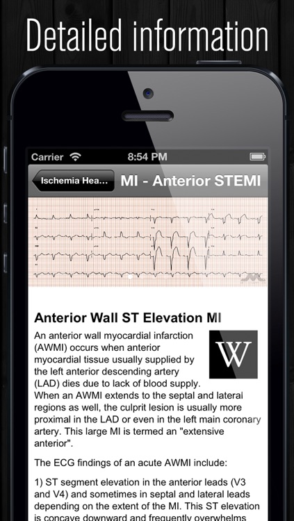 ECG Atlas screenshot-3