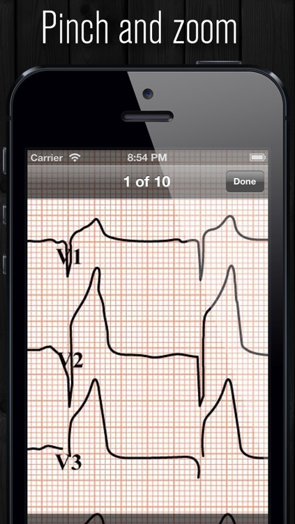 ECG Atlas