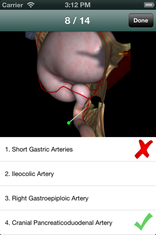 Equine GI & Abdomen Flashcards screenshot 4