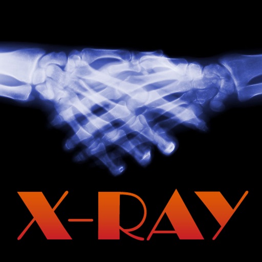 X Ray for iPhone 4 icon