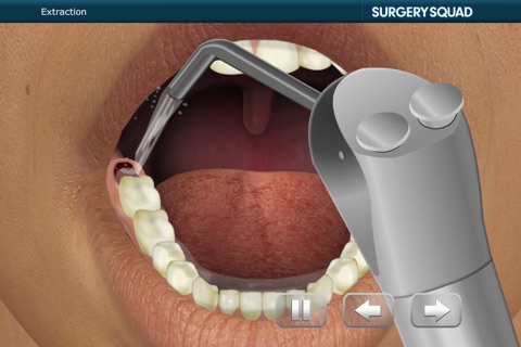 Surgery Squad's Wisdom Tooth Extraction screenshot 4