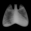 ACCP Radiology Cases