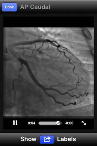 CathLab App screenshot 3