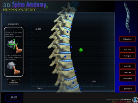 Anatomy Spine screenshot 3