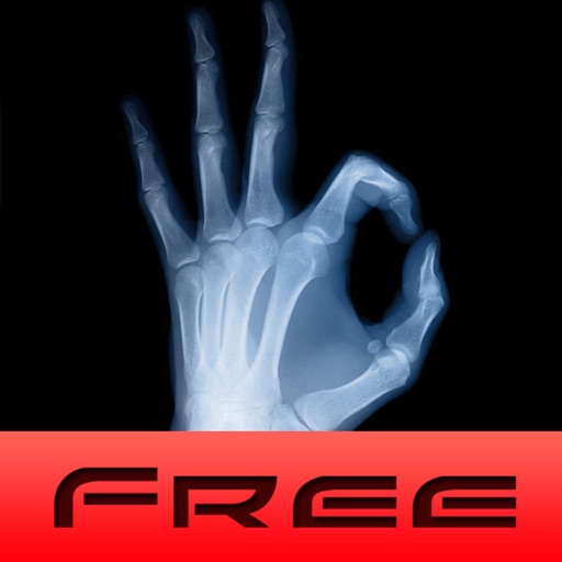 X ray lite for iPhone