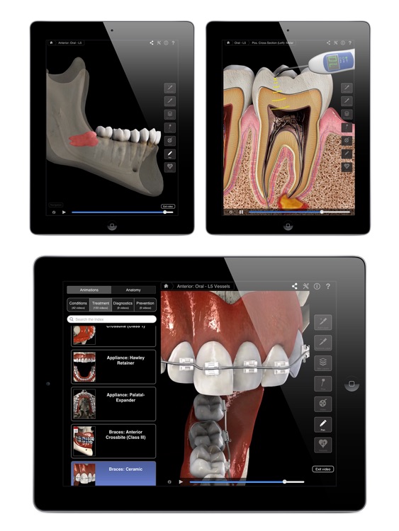 Dental Patient Education