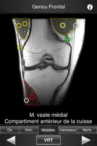 Monster Anatomy Lite - Knee screenshot 3